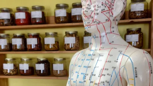 Acupuncture model with jars in background.