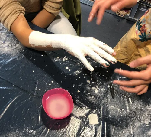 Arm wird in Gips gegossen, auf Tisch.