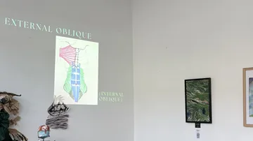 Wand mit anatomischem Diagramm projiziert.