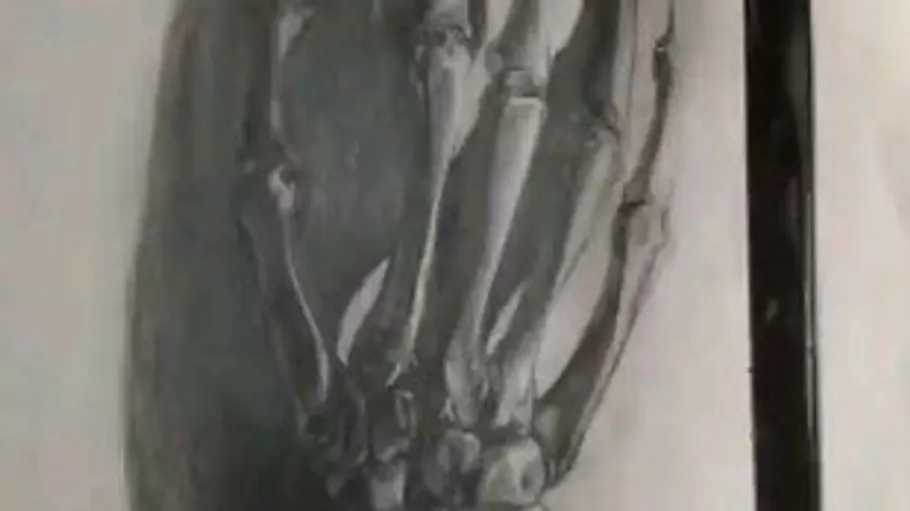 Bone hand is characterized by detailed shading.