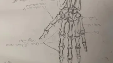 Drawing of a human hand bone, with inscriptions.
