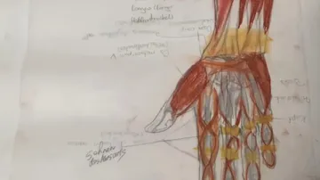 Anatomische Zeichnung einer Hand mit Muskeln und Beschriftungen.