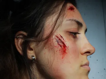 Wunde an einer Gesichtshaut, Blut läuft, düsterer Hintergrund.