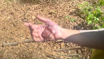 Person's hand injured in a forest clearing.