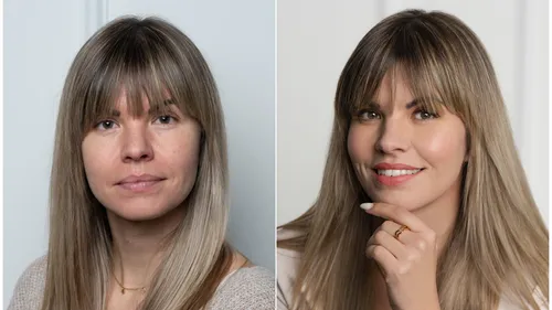 Woman's face in two comparison photos.